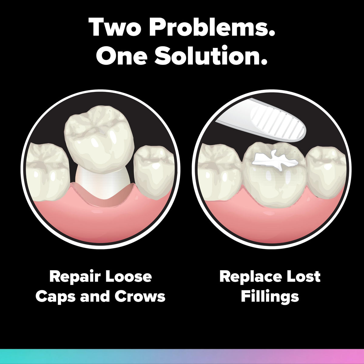 Loose Cap and Lost Filling Repair Dental Kit S66902